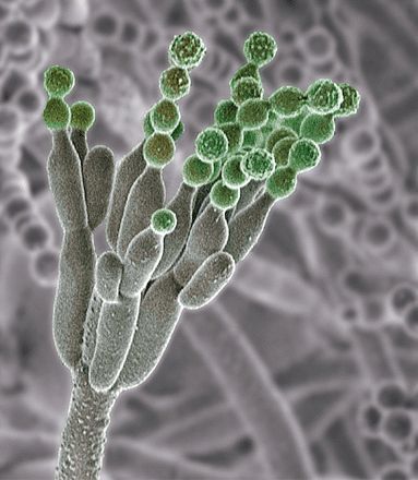 Mold spores magnified